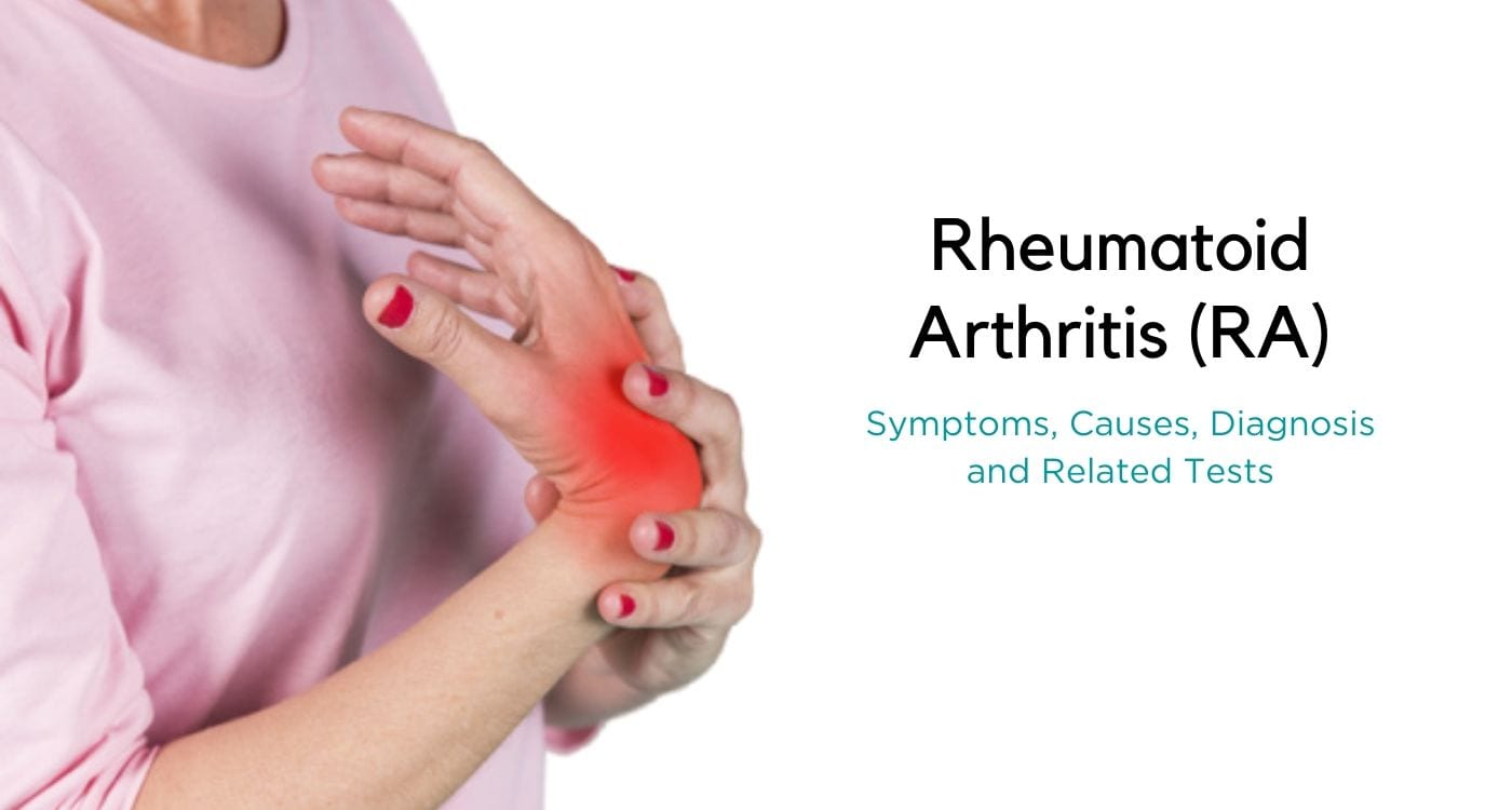 Rheumatoid Arthritis (RA): Symptoms, Causes, Diagnosis &  Tests