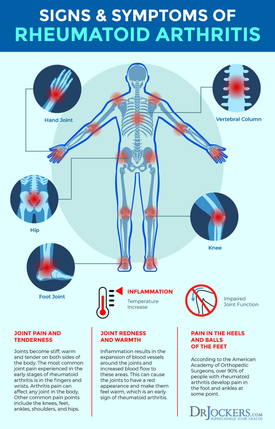 Rheumatoid Arthritis: Symptoms, Causes and Natural Support ...