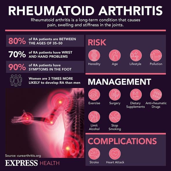Rheumatoid arthritis symptoms: Joint stiffness first thing in the ...