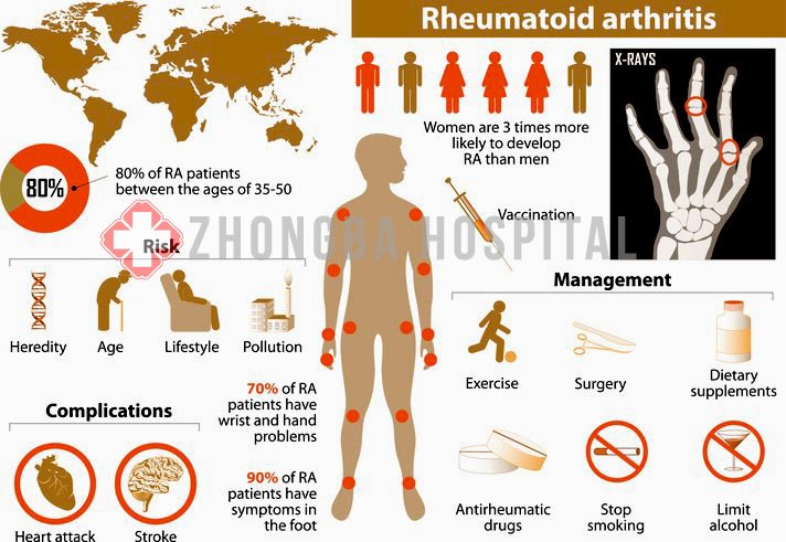 Rheumatoid Arthritis Treatment in Lahore