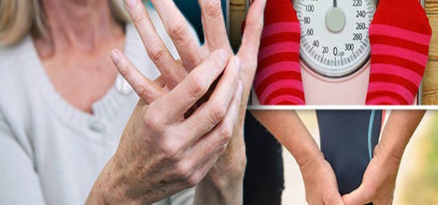 Rheumatoid Arthritis Weight Loss Cause