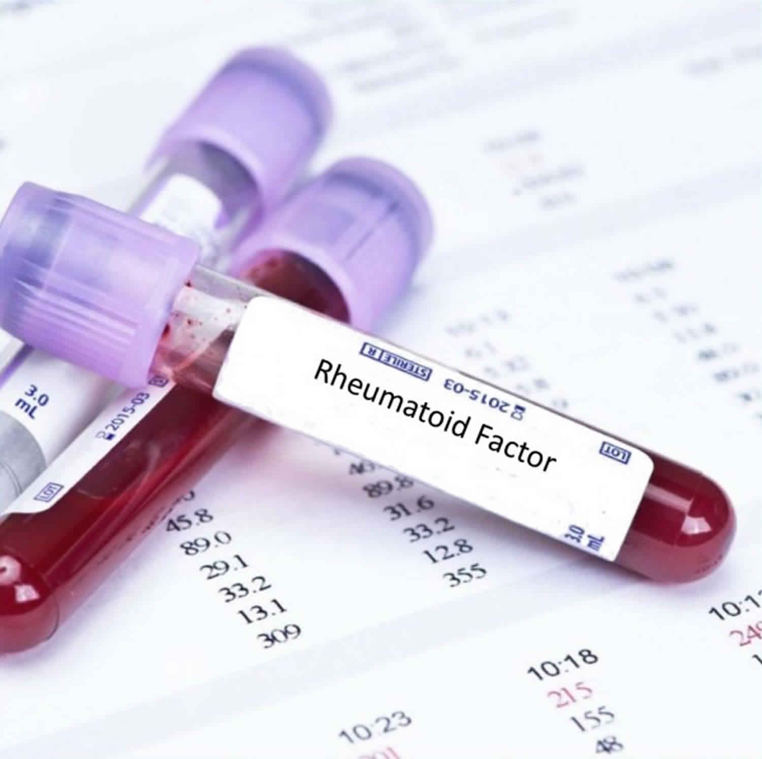 Rheumatoid factor, rheumatoid factor blood test uses ...