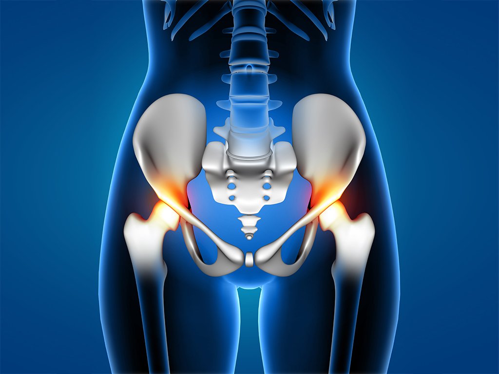 Right Groin Pain in Indians: Causes &  How to Prevent It