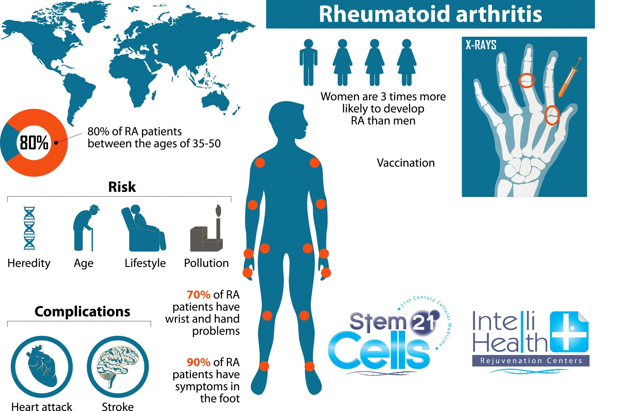 sc21 arthritis RA