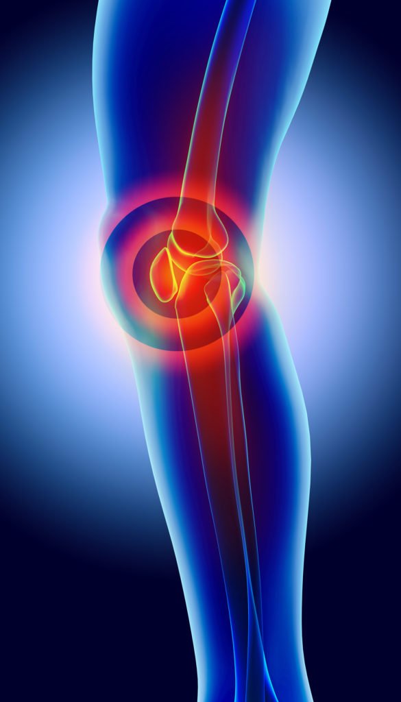 Seeking Knee Pain Relief in NJ?