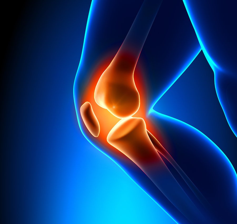 Shockwave for Knee Arthritis