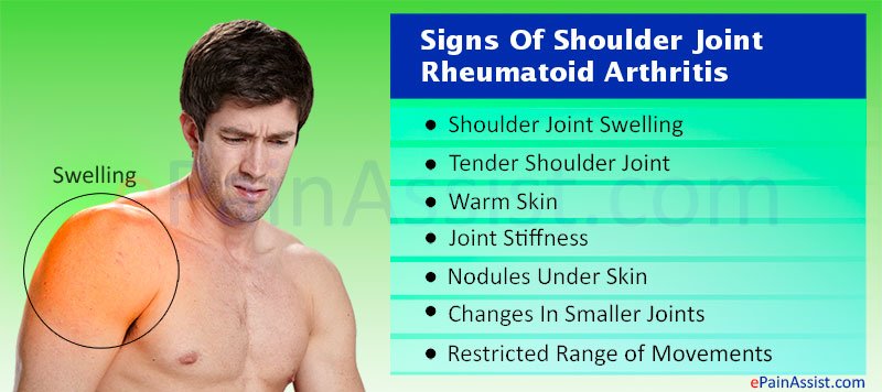 Shoulder Joint Rheumatoid Arthritis