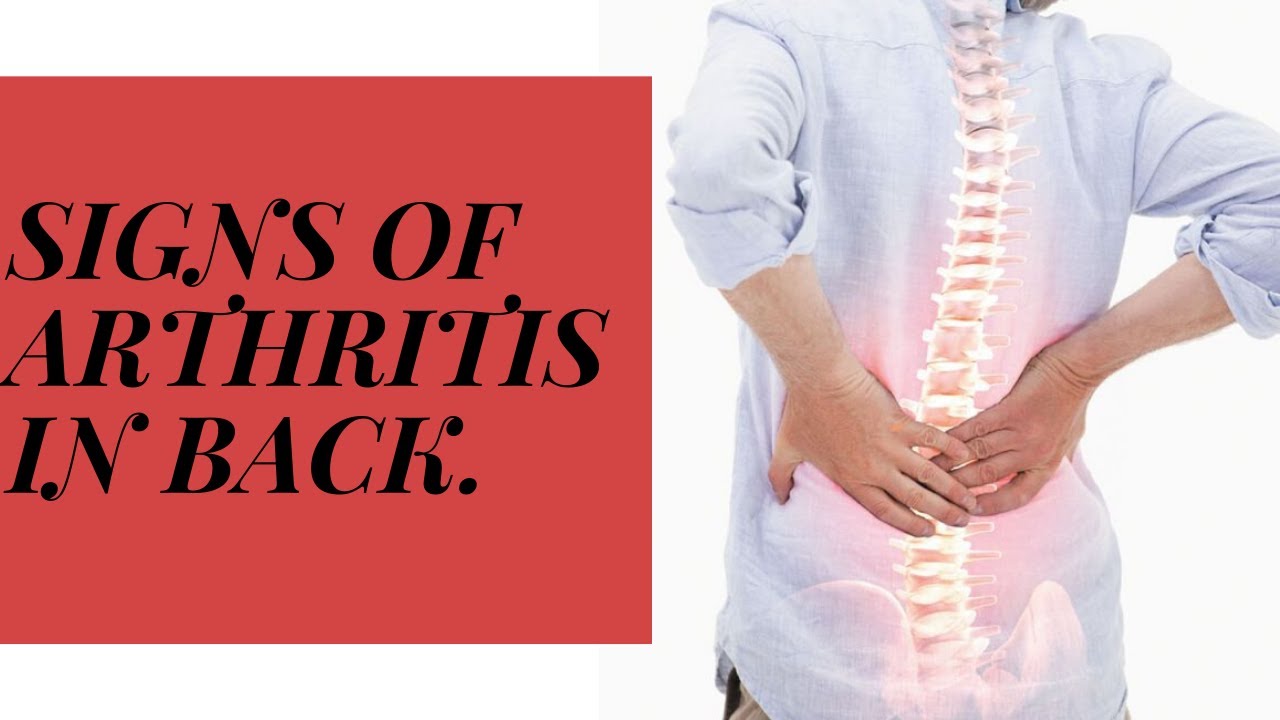 signs of arthritis in back