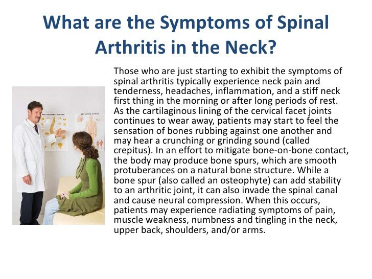 Spinal Arthritis Neck