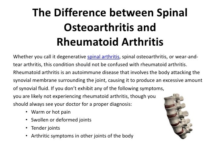 Spinal arthritis