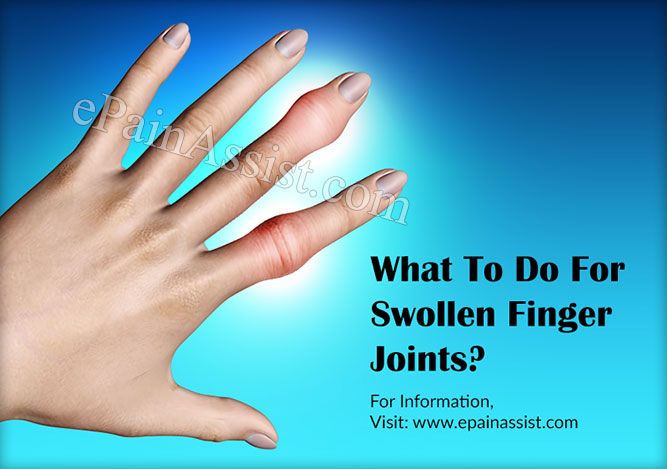 Swollen Finger Joints