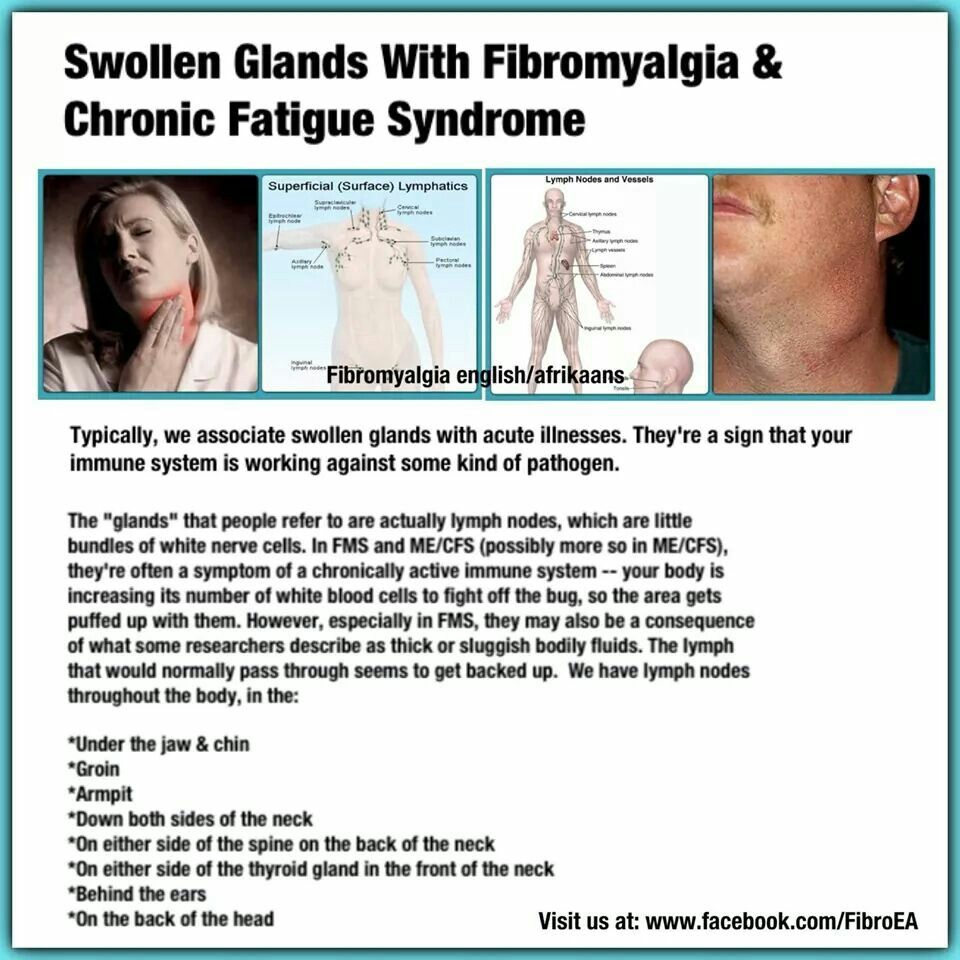 Swollen glands with fibromyalgia
