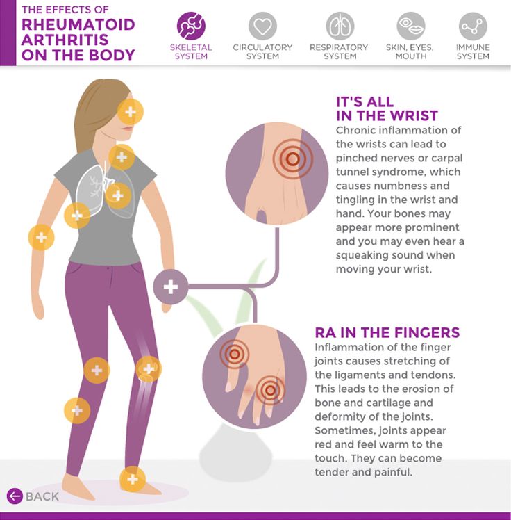 The effects of Rheumatoid Arthritis on the body