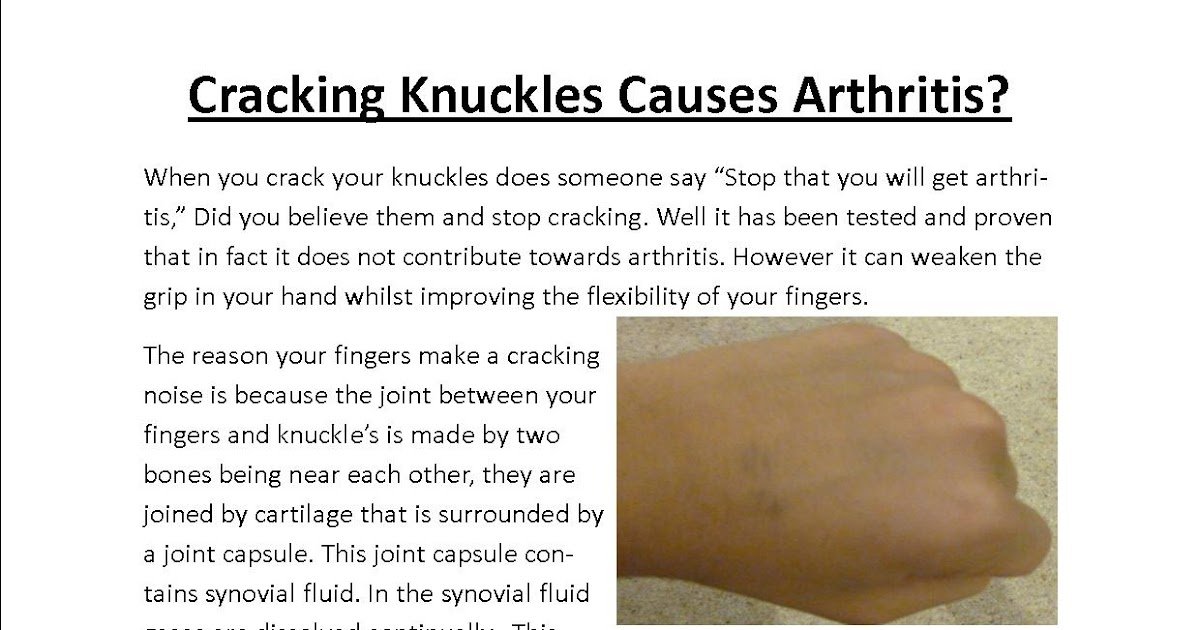 The West Bridgford School Report: Does Cracking Knuckles Causes Arthritis