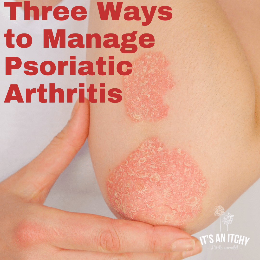 Three Ways to Manage Psoriatic Arthritis