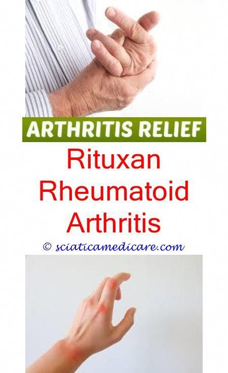 Tips On How To Properly Deal With Arthritis