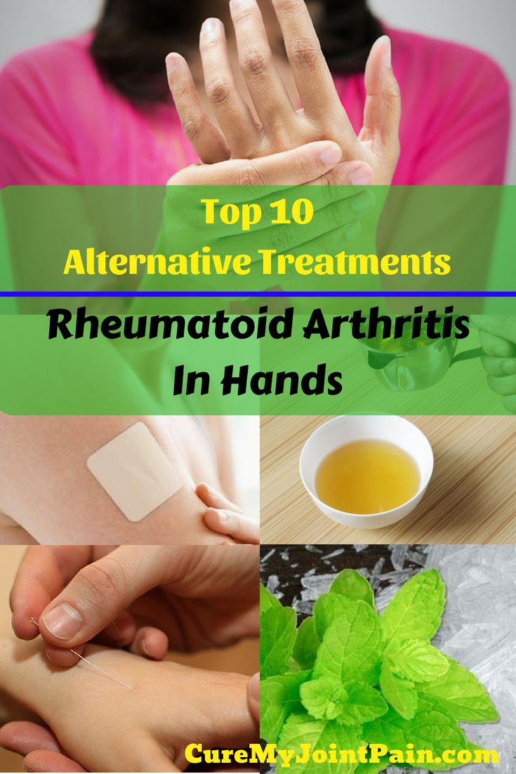 Top 10 Alternative Treatments For Rheumatoid Arthritis In Hands ...