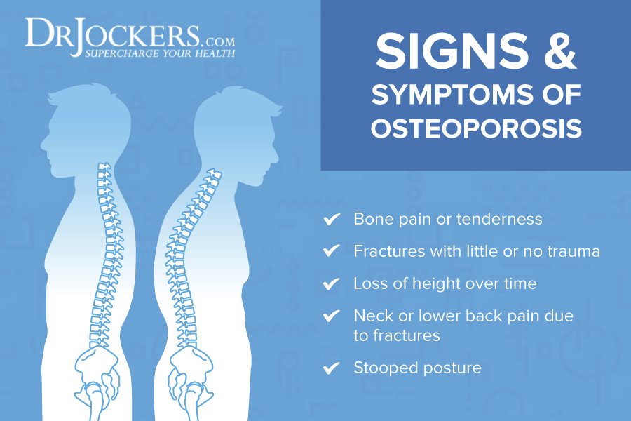 Top 10 Natural Strategies for Osteoporosis
