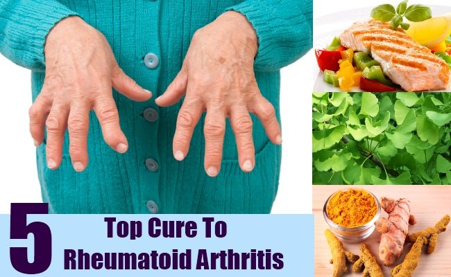 Top 5 Cures For Rheumatoid Arthritis
