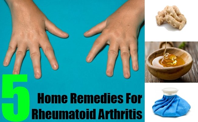 Top 5 Home Remedies For Rheumatoid Arthritis  Natural Home Remedies ...