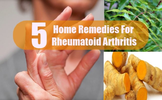 Top 5 Home Remedies For Rheumatoid Arthritis