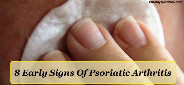 (Top 8) Early Signs Of Psoriatic Arthritis