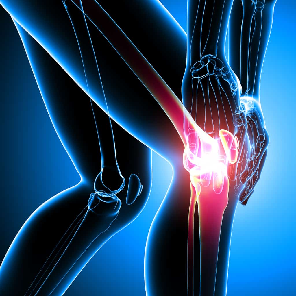 Treating the Arthritic Knee: Current Concepts in Rehabilitation of ...