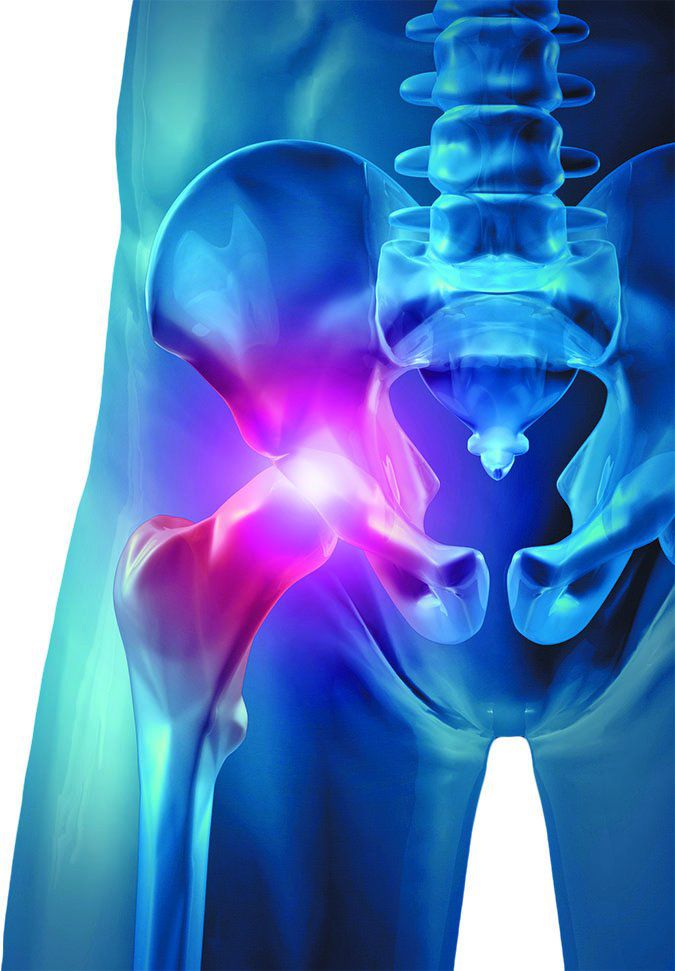 Troubleshooting Hip Pain: Part II