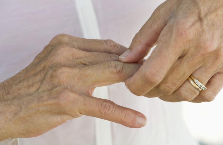 Types of Arthritis: Finger Arthritis