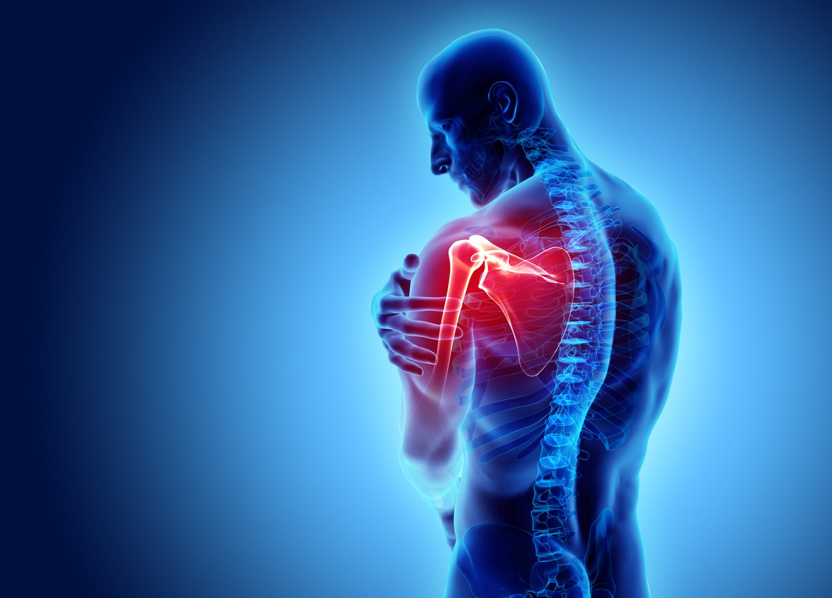 Types of Arthritis that Affect the Shoulder