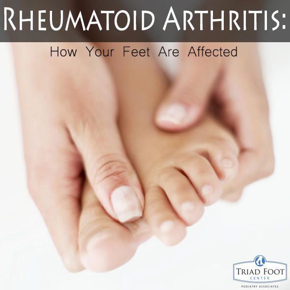Unfortunately, arthritis can afflict almost any joint in the body ...