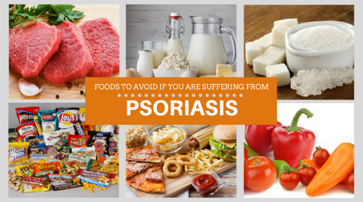 Use These Simple Tips To Improve PSORIASIS