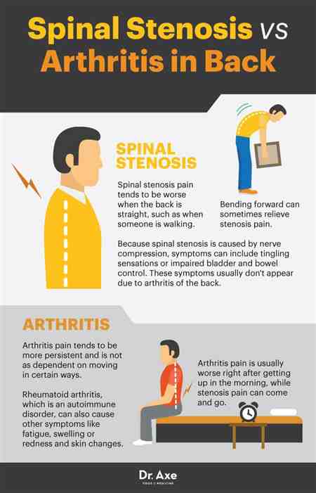 Va Disability Back Arthritis Treatment Back Pain ...