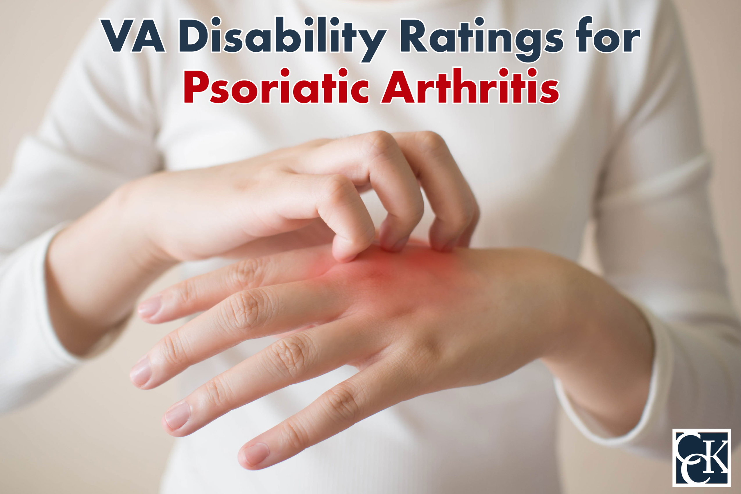 VA Disability Ratings and Benefits for Psoriatic Arthritis ...
