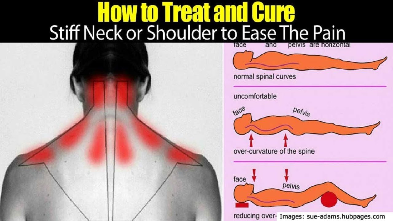Ways &  How to Get Rid of a Stiff Neck.