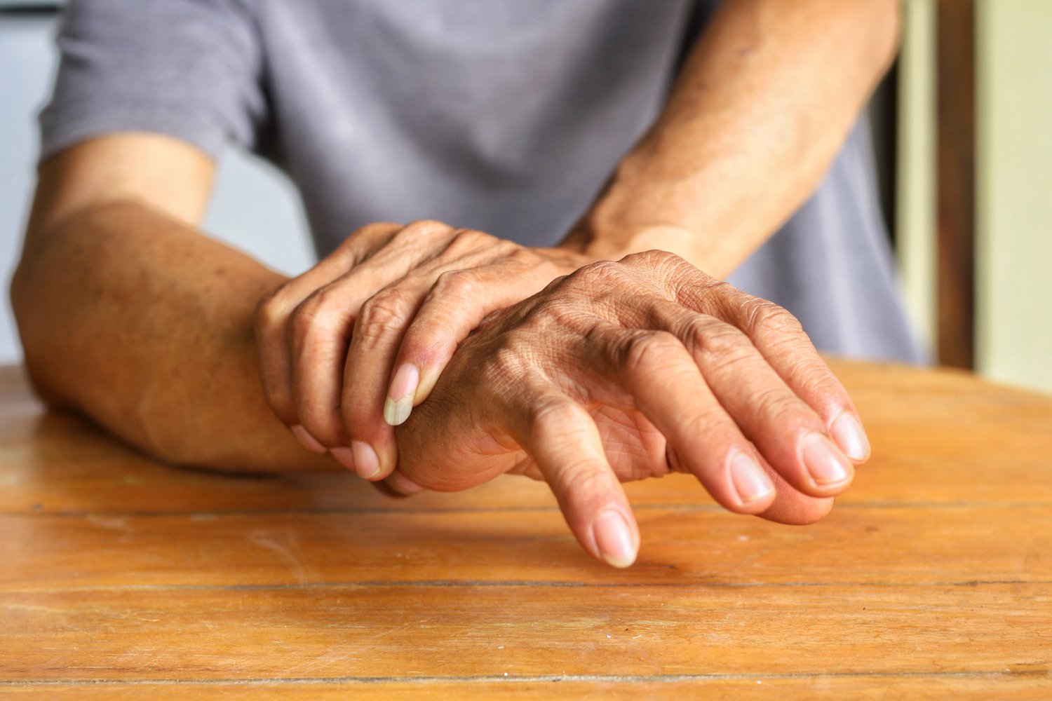 Ways To Manage Psoriatic Arthritis With Lifestyle Changes ...