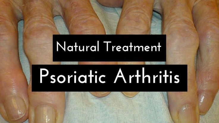 What are the Main Causes of Psoriatic Arthritis ...