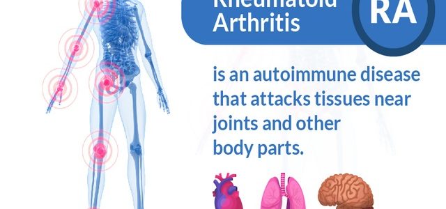 What Are The Major Causes Of Rheumatoid Arthritis