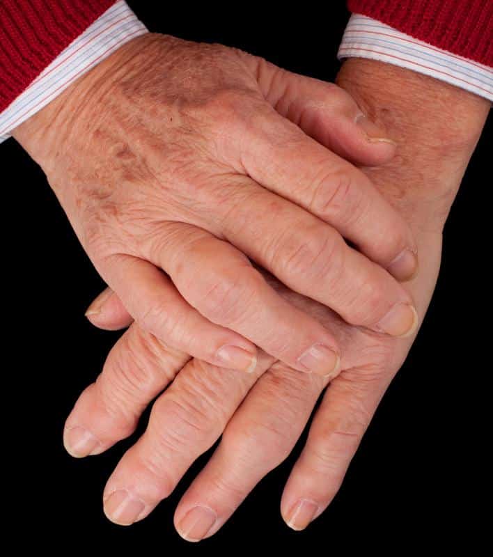 What are the Most Common Causes of Swelling Fingers?