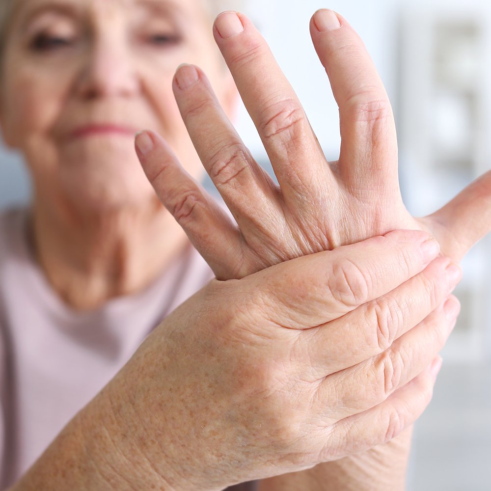What Are The Signs of Arthritis In My Hands and Fingers?