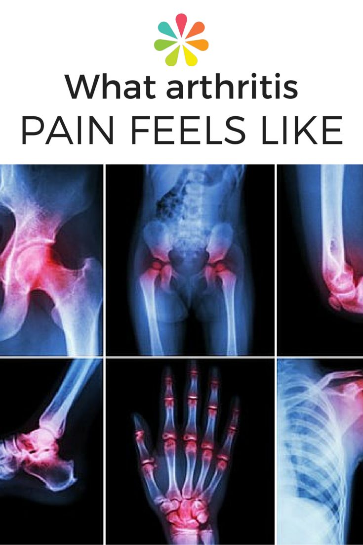 What Arthritis Pain Feels Like
