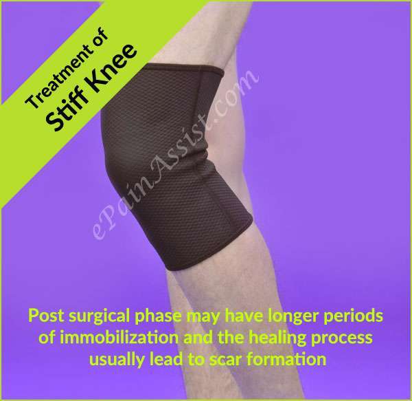 What Causes Stiff Knee Pain