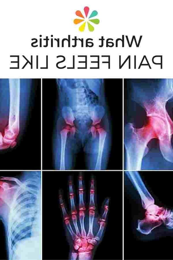 What Does Arthritis Pain Feel Like In The Knee Flare Knee * Arthritis ...