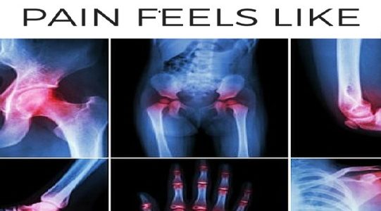 What Does Rheumatoid Arthritis Pain Feel Like