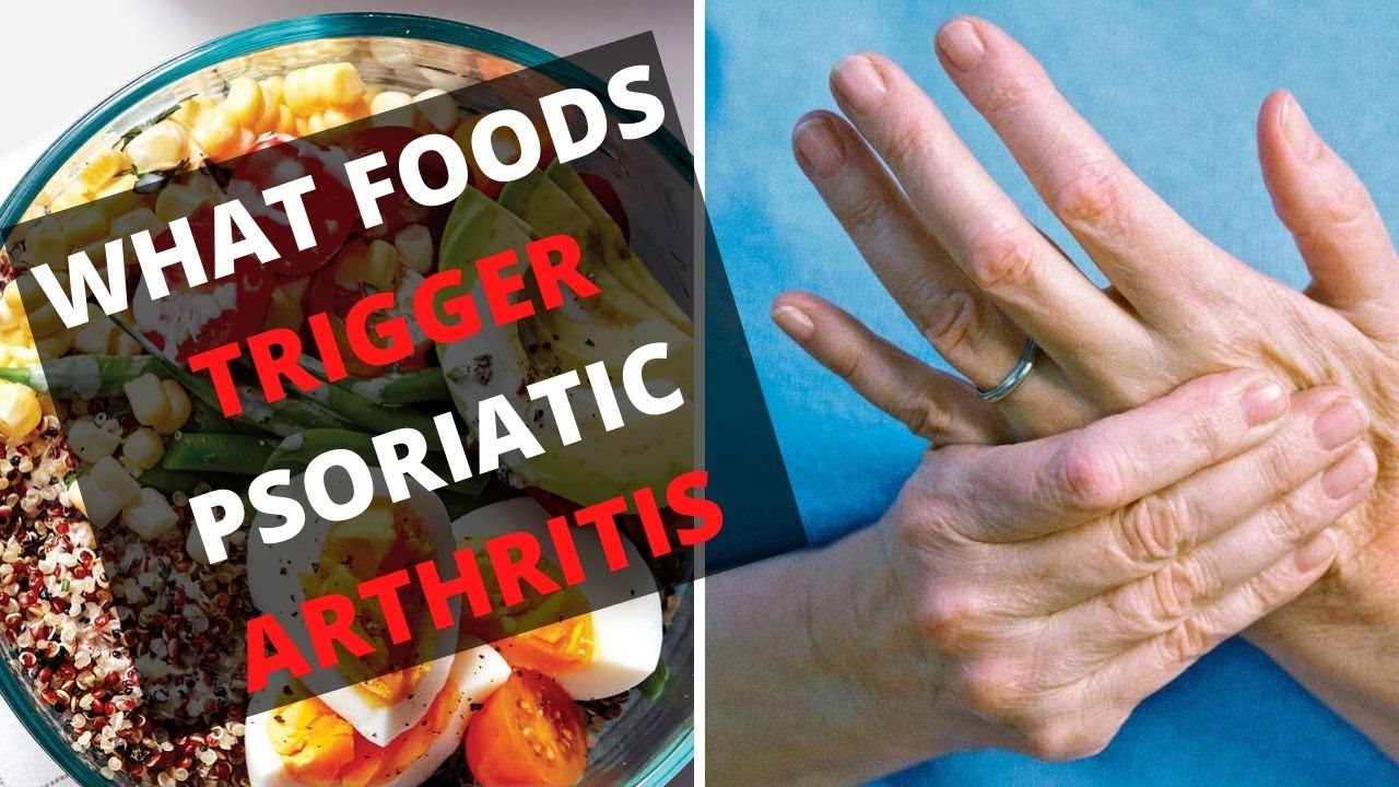 ¿WHAT FOODS TRIGGER PSORIATIC ARTHRITIS? ?