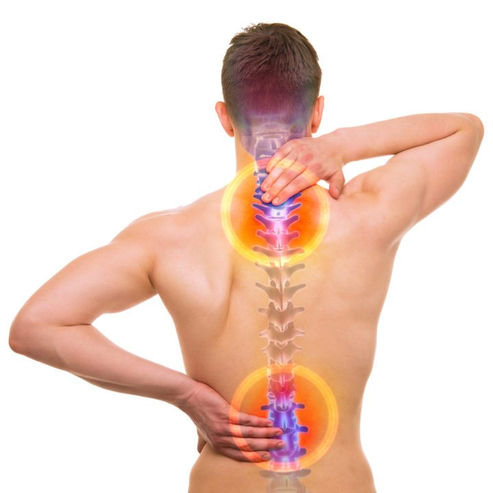 What happens if you do not treat Spinal Stenosis ...