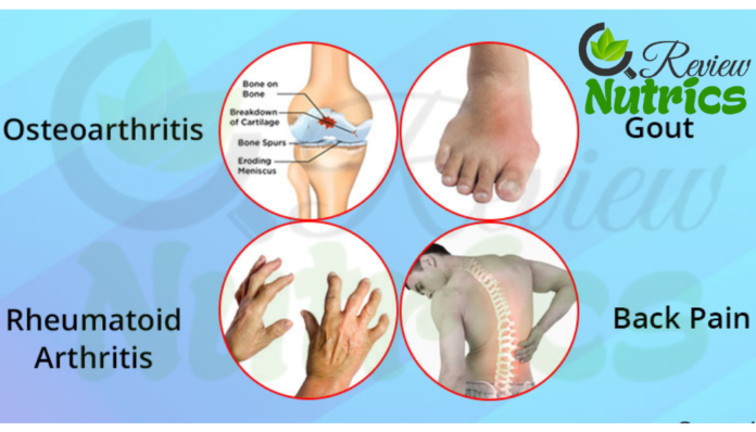 What is Arthritis and Most Common Types and Causes of ...