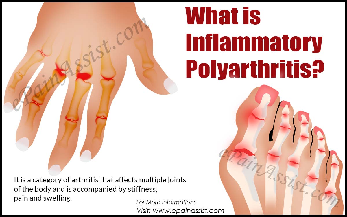 What is Inflammatory Polyarthritis
