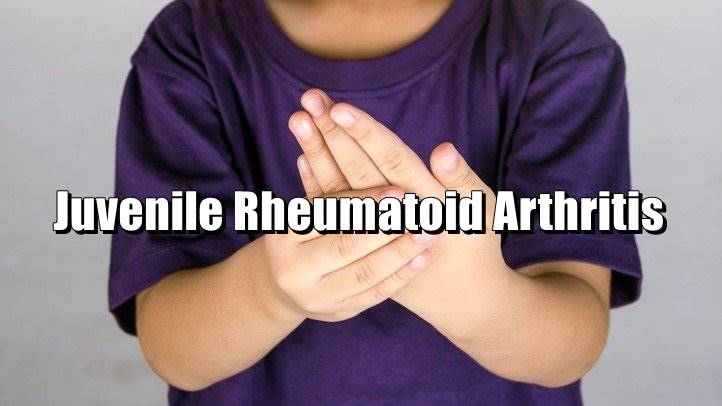 What is Juvenile Rheumatoid Arthritis: Symptoms ...