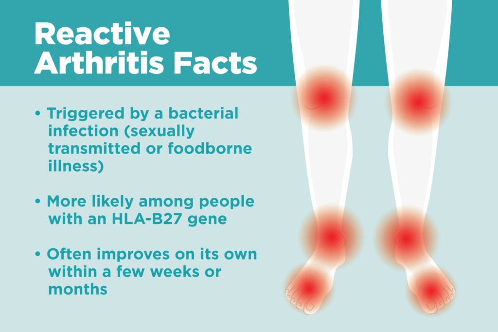 What Is Reactive Arthritis? Understanding Symptoms, Causes ...